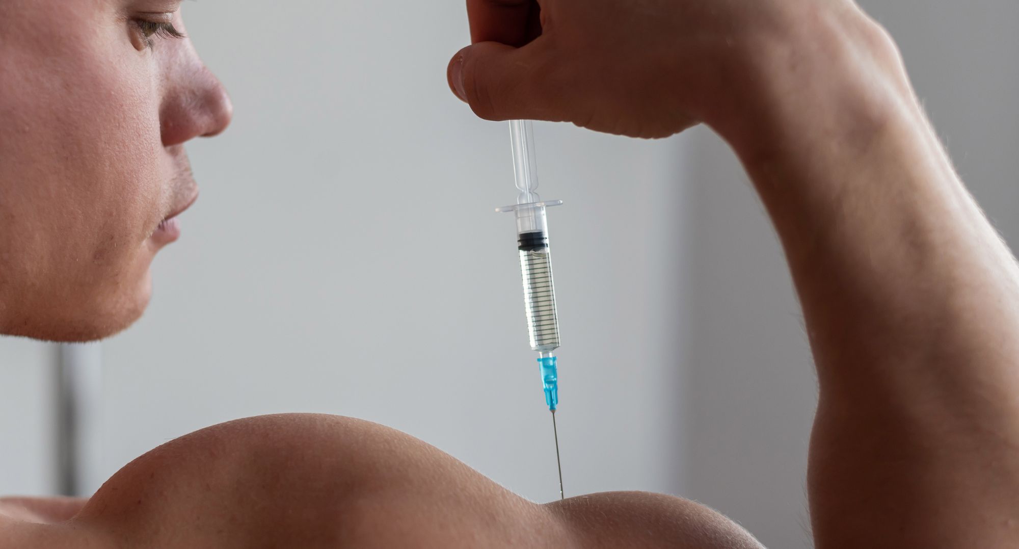 Анаболічні стероїди: що це таке і як вони змінюють тіло